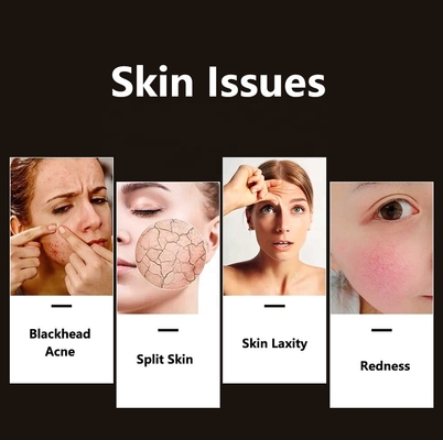 Compact Skin Led Gesichtslichttherapie zur Akneverbesserung
