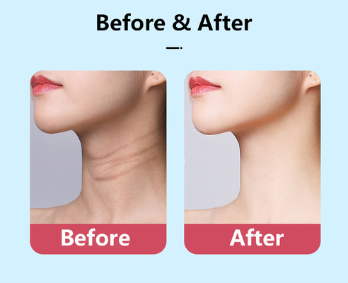 Nennleistung 2,5 W LED-Therapie Halsverjüngung V-Gesicht Lifting Massager für Anti-Aging