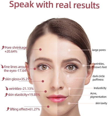 46G Warm-Anti-Aging-Augen-Massager Stift-Stab für Gesicht Hals Augen Körper EMS Mikrokurrent