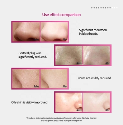 130*56*28 Silikon-Gesichtswaschbürste mit drahtlosem Aufladen und IPX6 wasserdichtem Massage